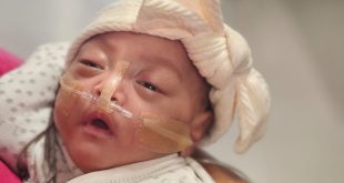 At just 22 weeks, Talia defies the odds as UAE’s youngest surviving baby at King’s College Hospital London, Dubai